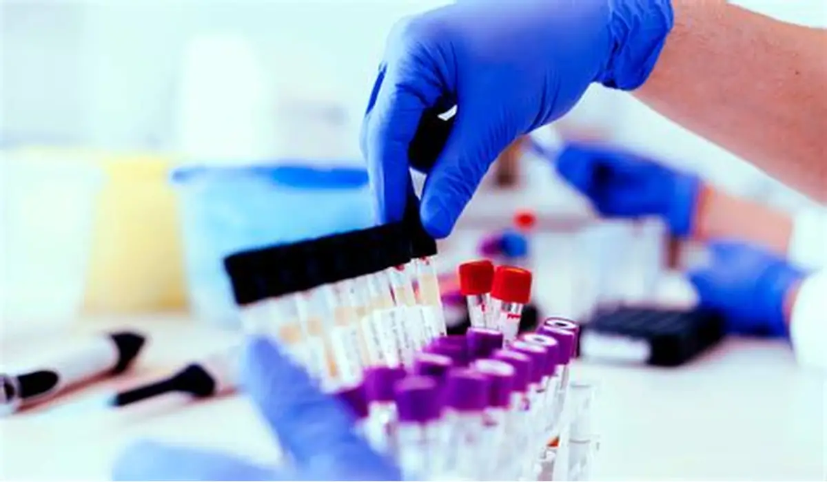 Labs and Diagnostics